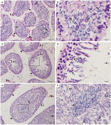 Molecular and Cellular Mechanisms of Apoptosis during Dissociated Spermatogenesis